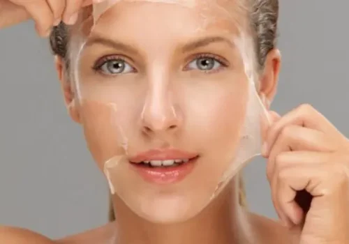 peeling-quimico1-1-748x380